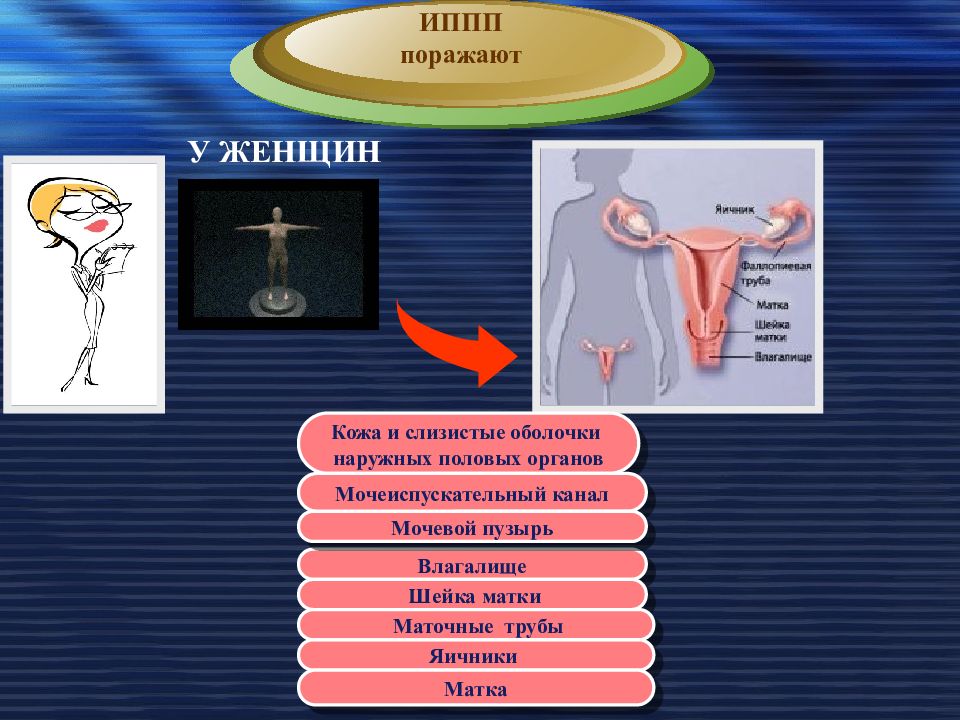 Клиническая картина зппп