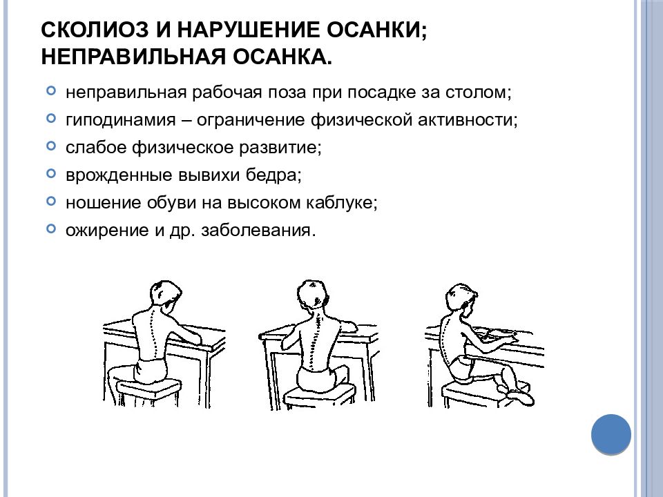 Перечислить нарушения осанки. Нарушение осанки причины и профилактика. Профилактика нарушения осанки. Неправильная рабочая поза. Причины нарушения правильной осанки.