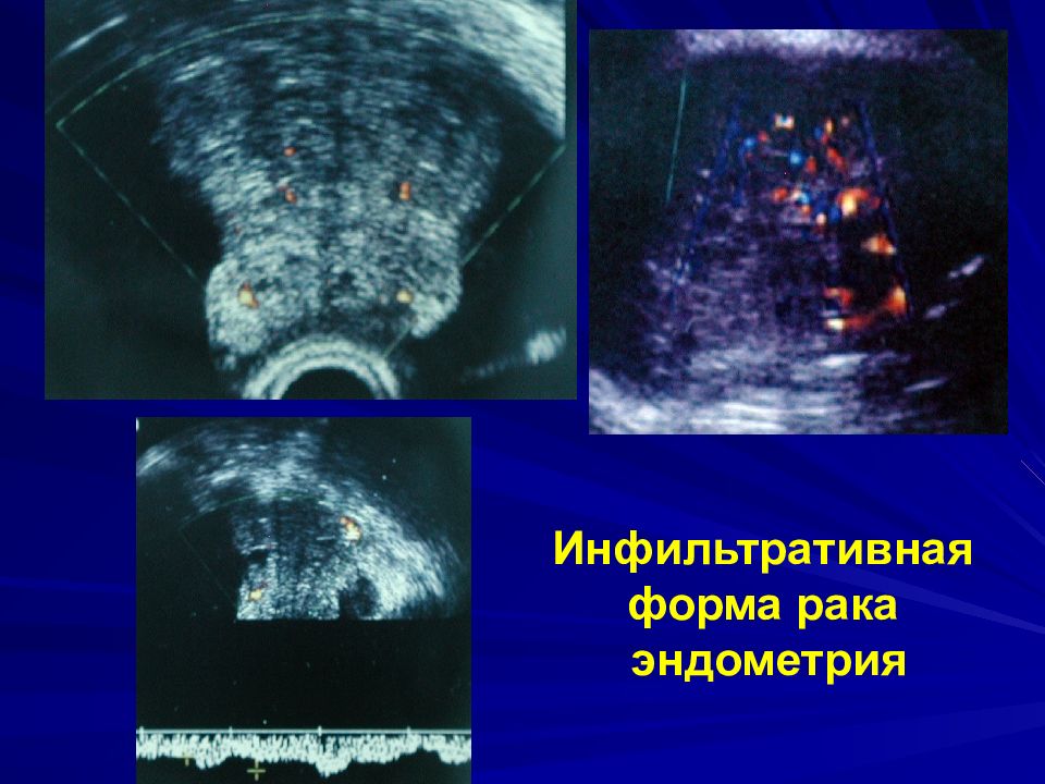 Ультразвуковая дифференциальная диагностика