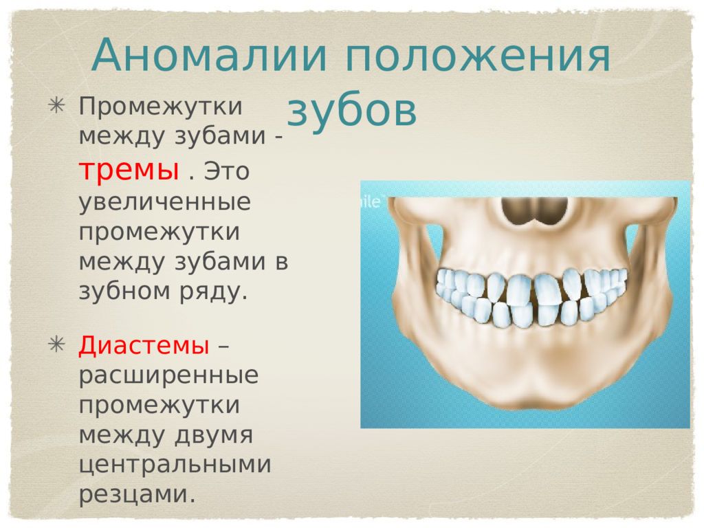 Основы окклюзионной диагностики презентация