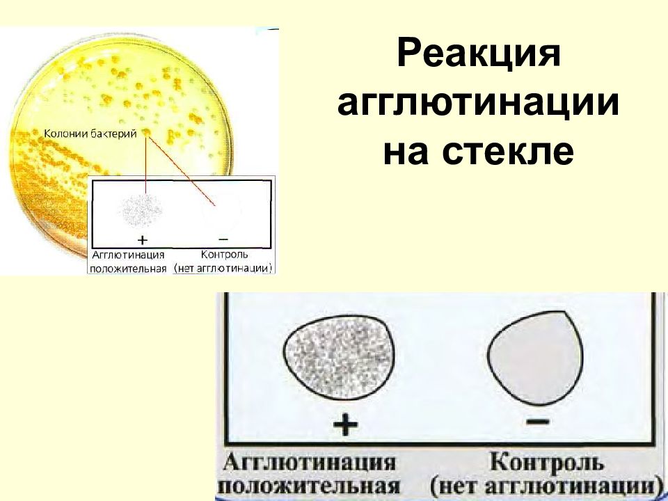 Реакция агглютинации фото