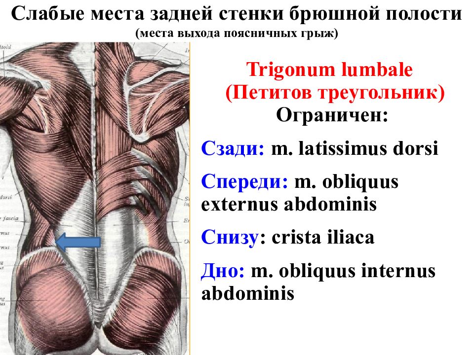 Слабые места. Грыжа Лесгафта Грюнфельда. Треугольник Лесгафта Грюнфельда. Поясничный треугольник Лесгафта Грюнфельда. Поясничный четырехугольник Грюнфельда-Лесгафта.