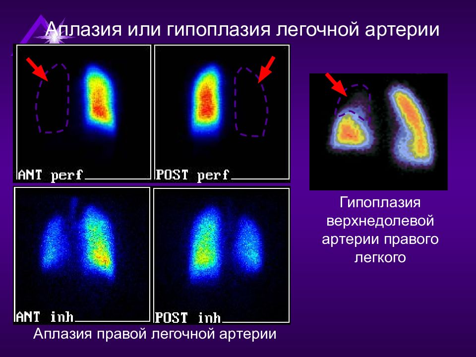 Радионуклидная диагностика. Радионуклидная диагностика легких. Радионуклидные методы легких. Основы радионуклидной диагностики лучевая диагностика.