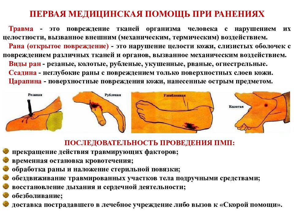 Презентация по обж первая медицинская помощь при кровотечениях