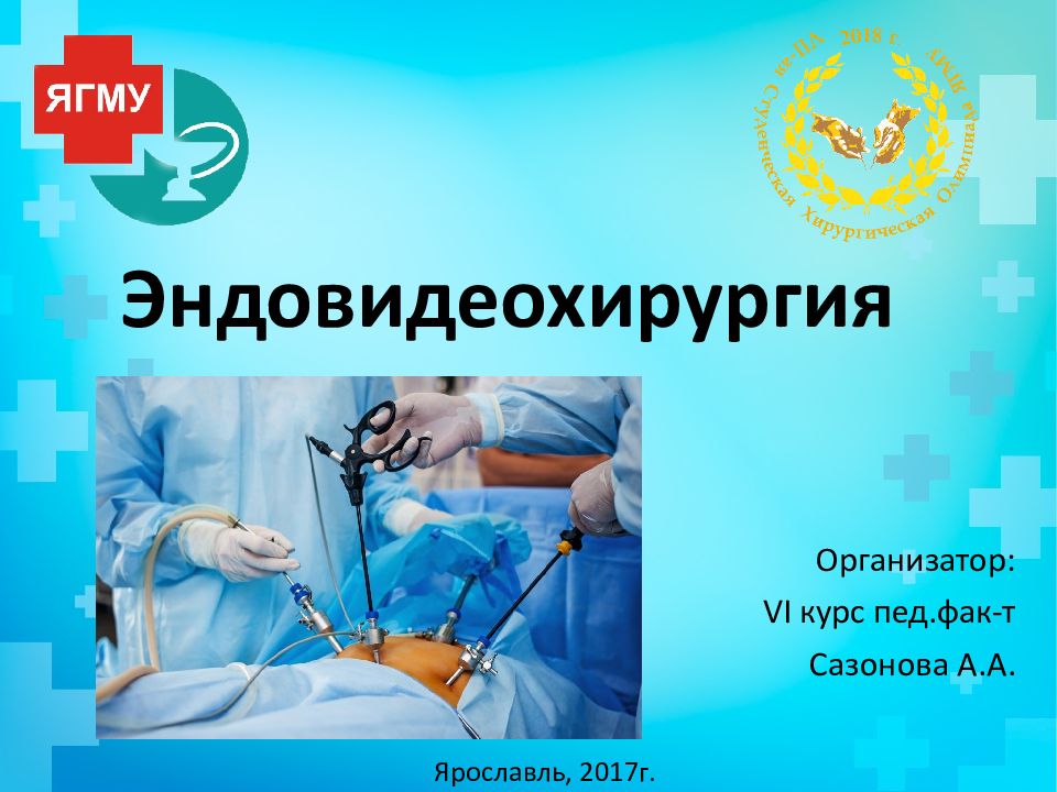 Эндовидеохирургия