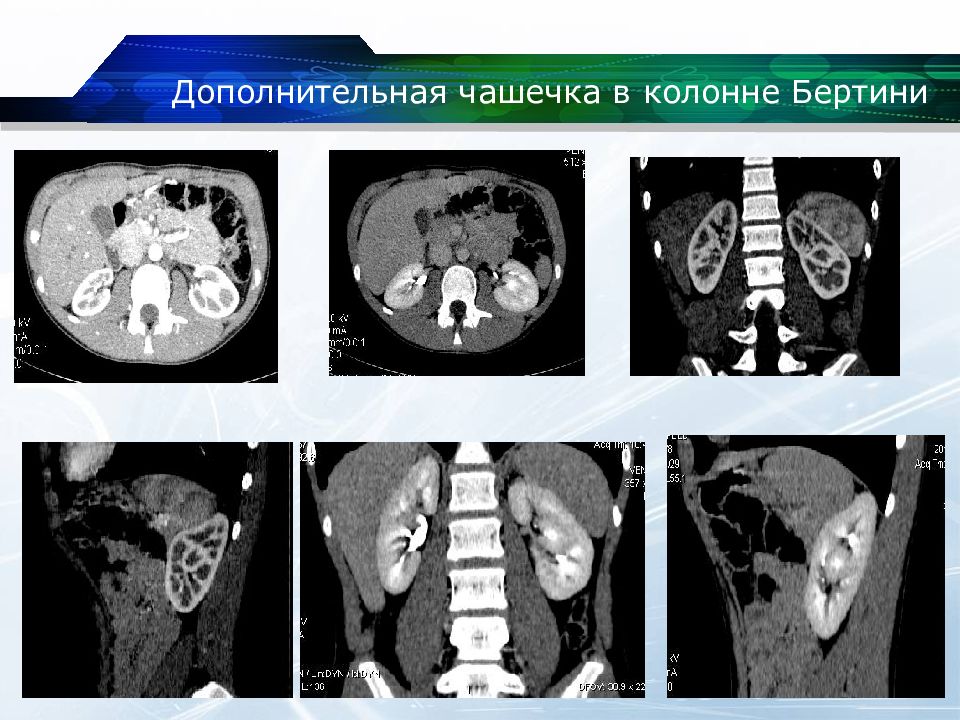 Кт почек презентация