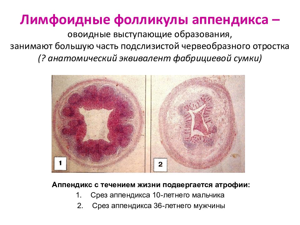 Лимфоидные фолликулы. Лимфоидные фолликулы в аппендиксе. Лимфоидные образования червеобразного отростка. Лимфоидные фолликулы червеобразный отросток. Лимфоидная ткань аппендикса.