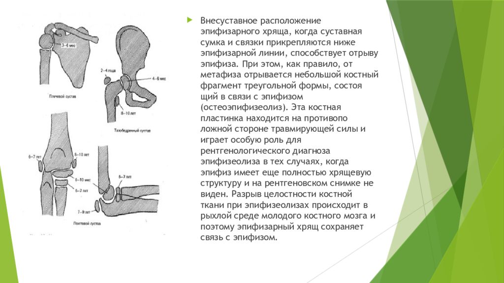 Перелом костей у детей. Эпифизарный хрящ. Особенности переломов у детей. Эпифизарный хрящ кости. Внесуставное расположение эпифизарного хряща.