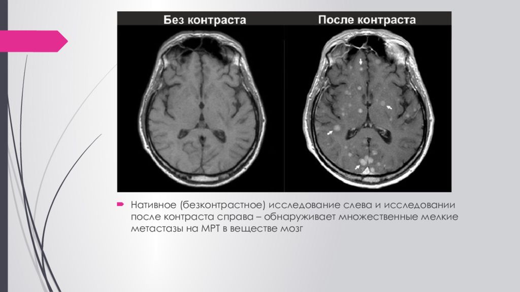 Контраст мрт побочные эффекты. Мрт лучевая диагностика. Контраст для мрт побочные. Контрастные и бесконтрастные исследования это. Основные нативные (бесконтрастные) методики, применяемые кт..