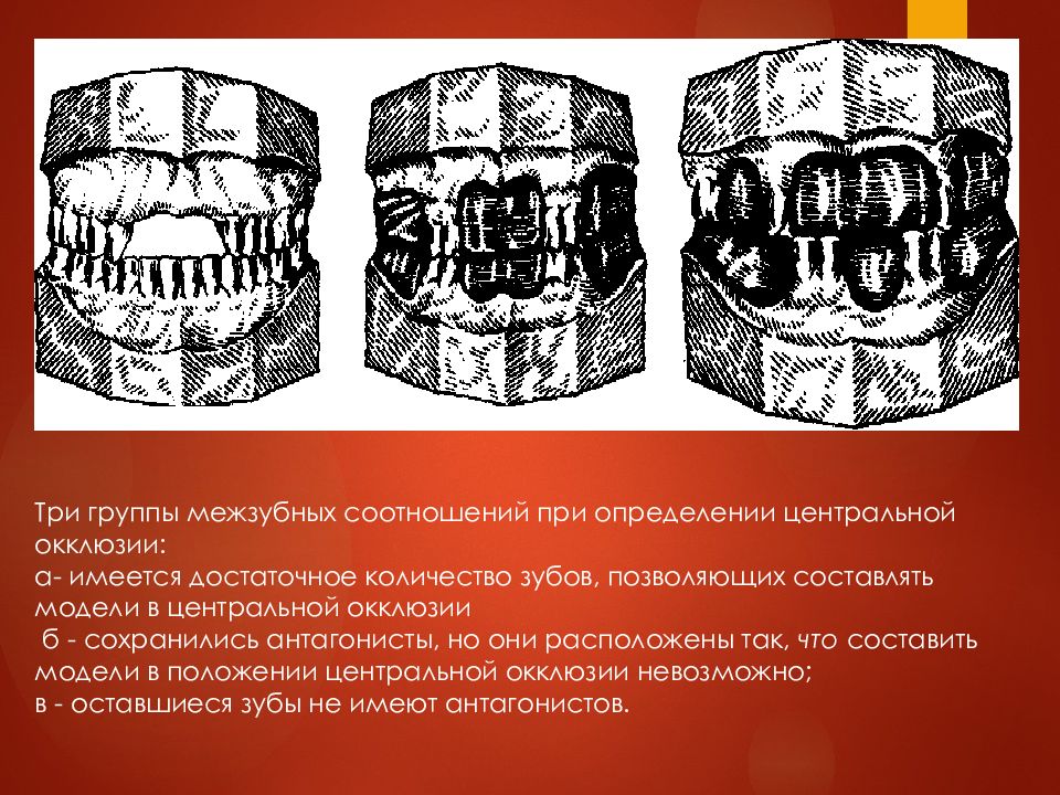 Определение центрального соотношения челюстей при полном отсутствии зубов презентация