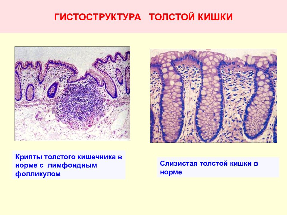 Слизистый эпителий. Крипты толстой кишки гистология. Толстая кишка гистология крипты. Крипты Толстого кишечника гистология. Крипт слизистой оболочки кишечника что это такое.