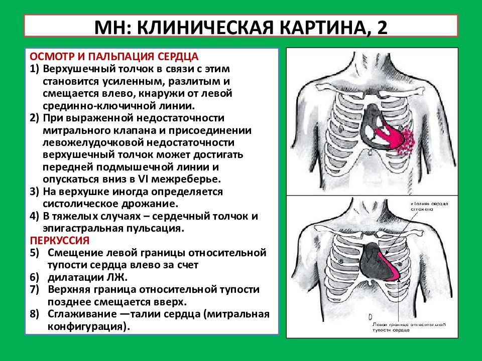 Презентация пороки сердца пропедевтика