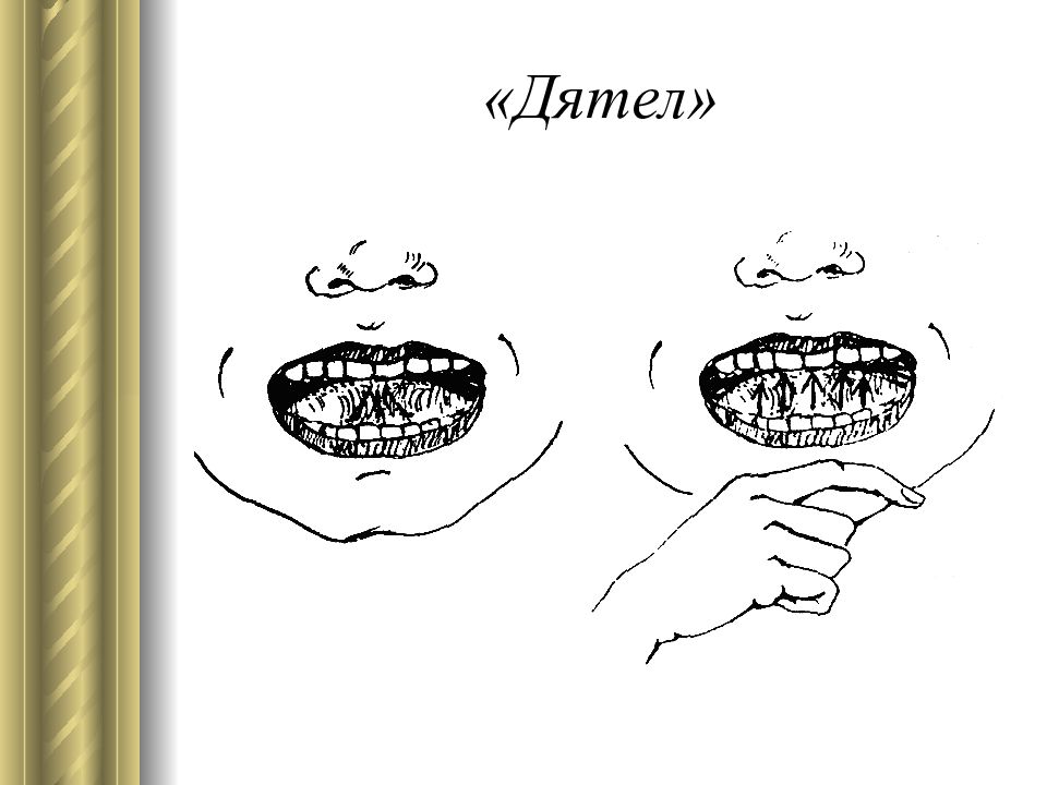 Мишка артикуляция аааааа.