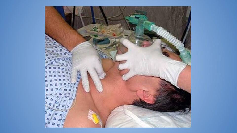 Трудные дыхательные пути в анестезиологической практике. Difficult Airway