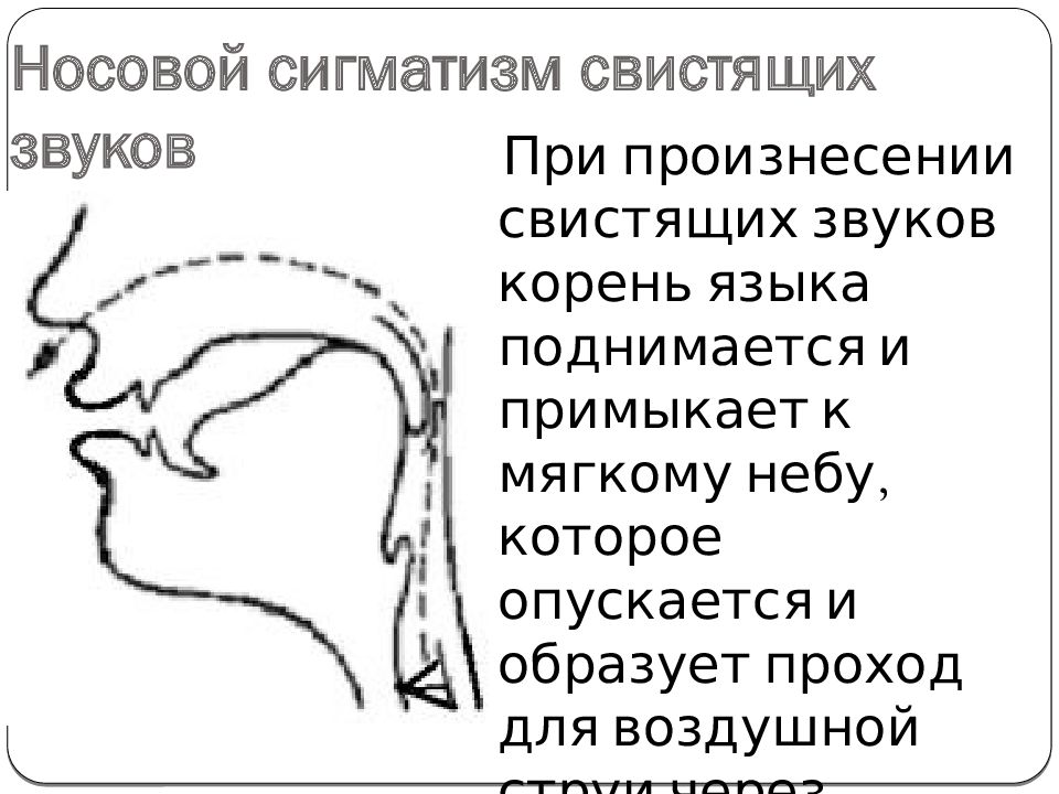 Сигматизм шипящих Сигматизм шипящих