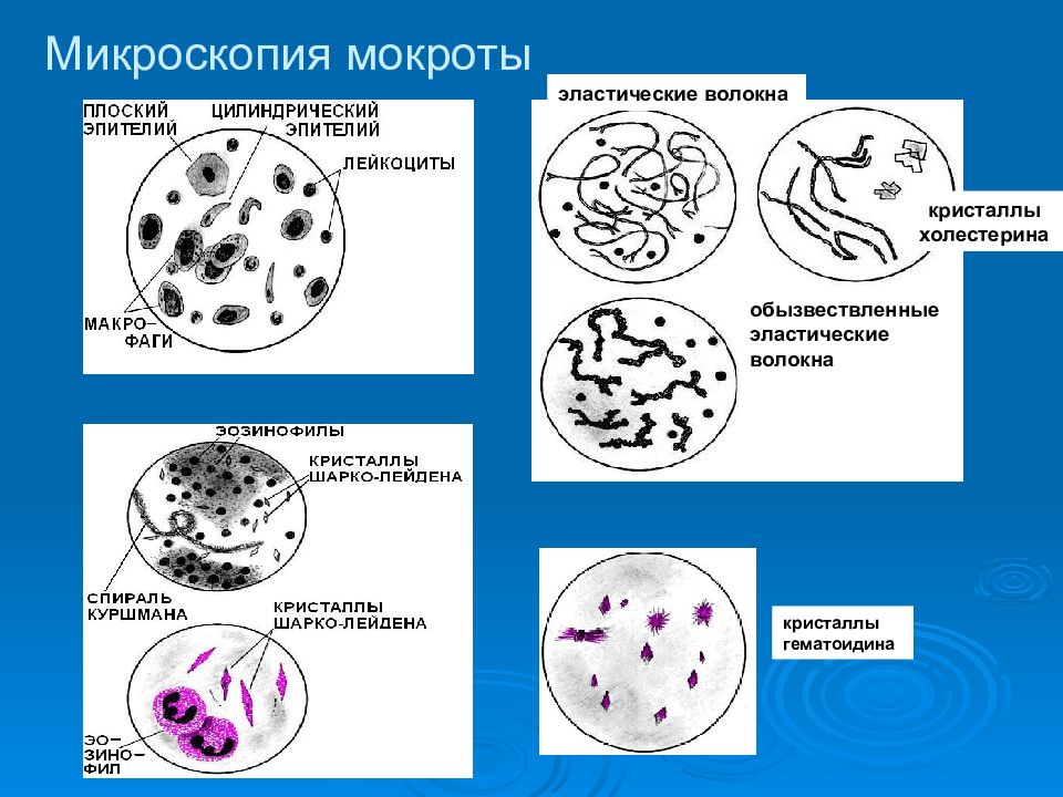 Микроскопия мокроты в картинках с описанием