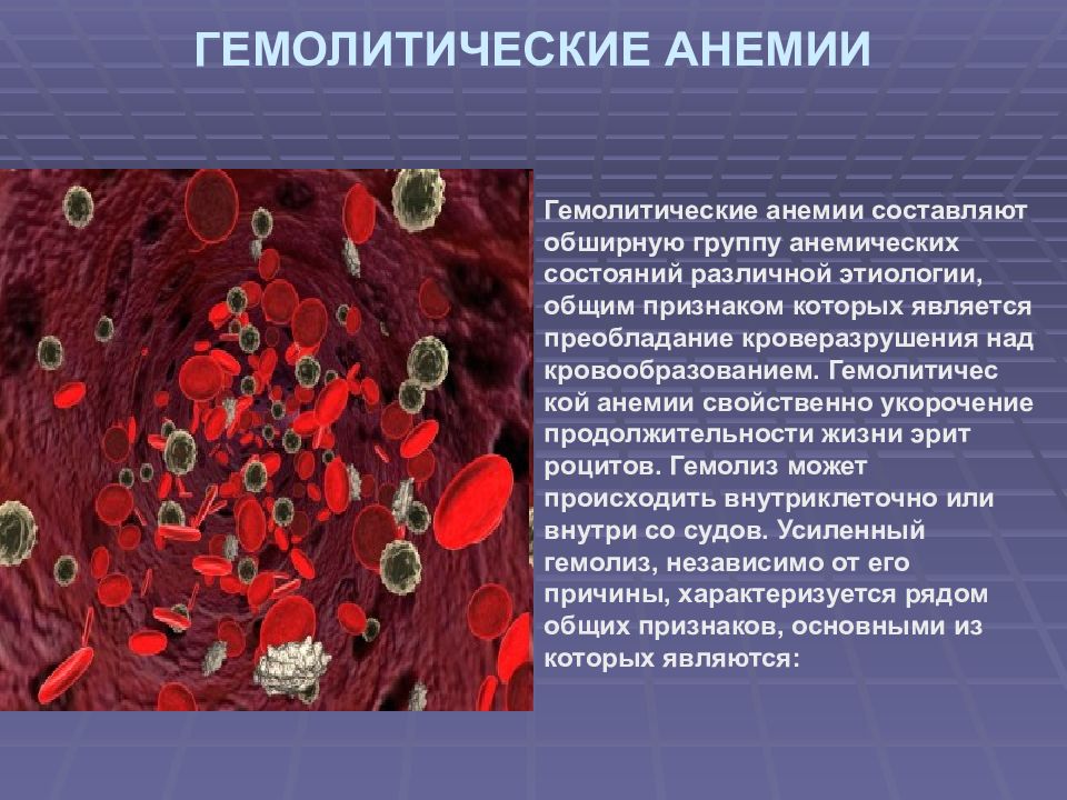 Анемия гемолитического типа