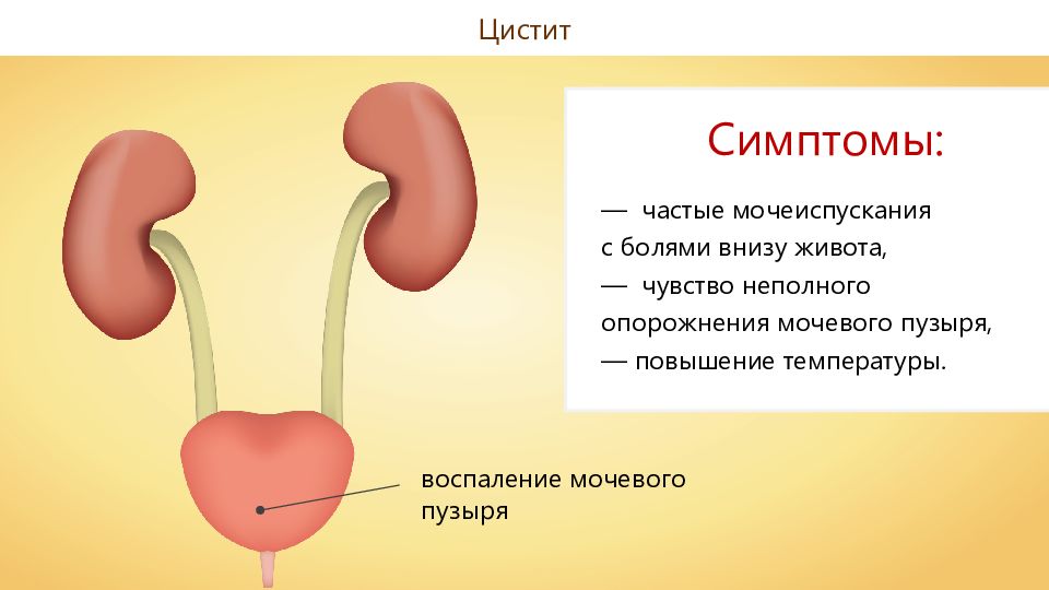 Заболевания органов мочевыделения презентация 8 класс пасечник