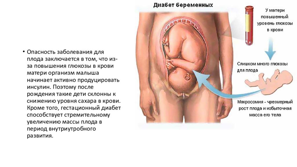 Гестационный сахарный диабет презентация