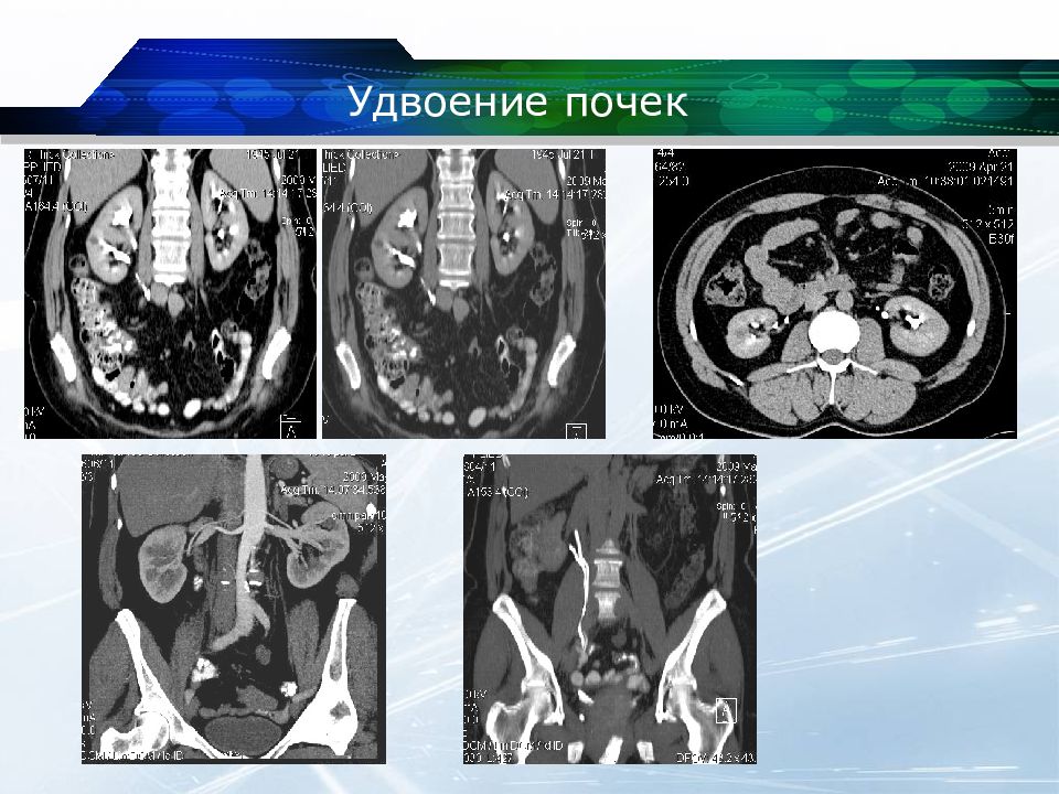 Кт почек презентация
