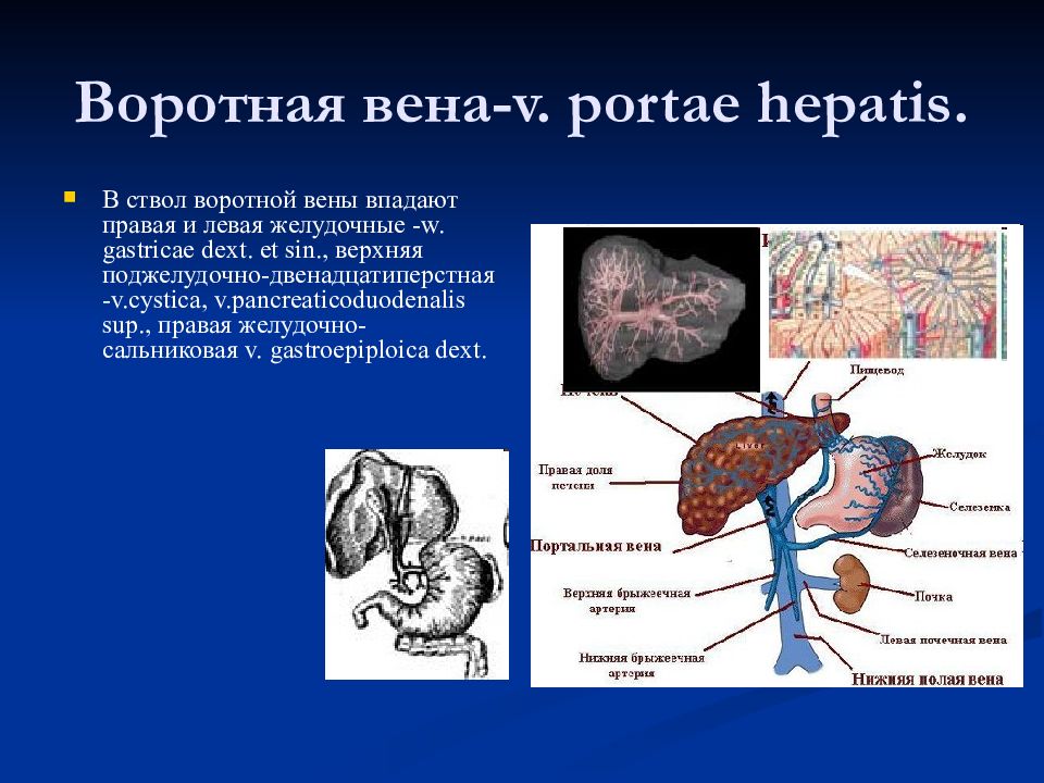 Воротной вене. Ветви воротной вены в печени. Воротная Вена печени анастомозы.