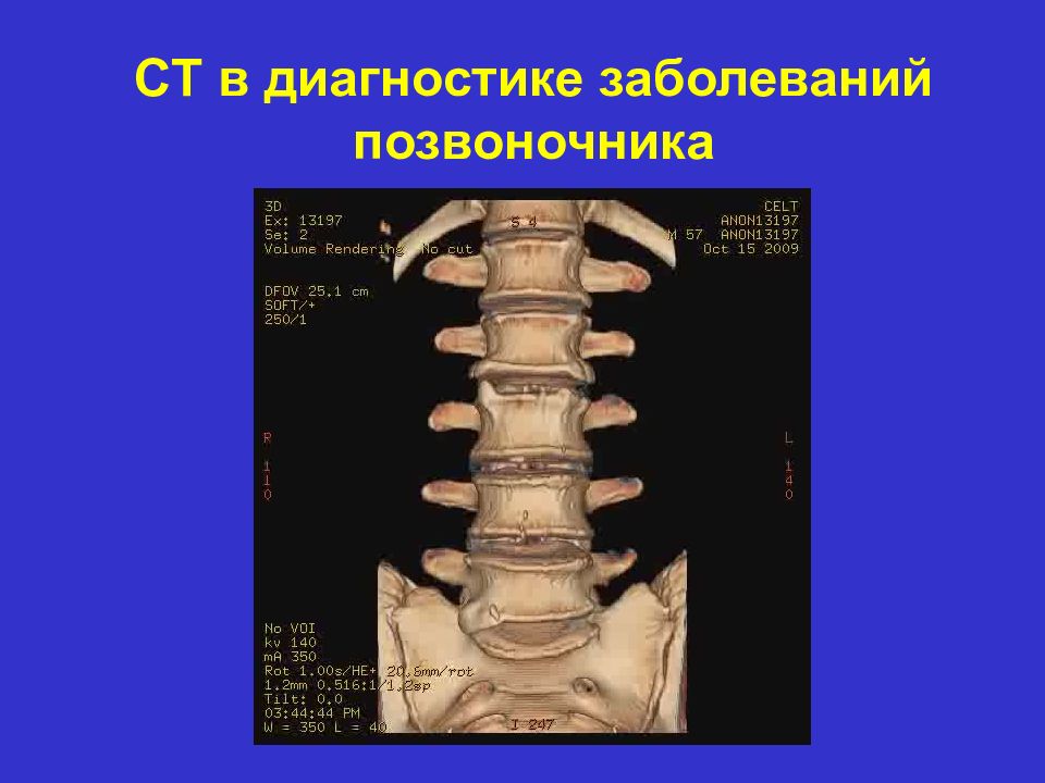 Нарушение позвоночника. Заболевания позвоночника список. Нарушения позвоночника. Заболевания позвоночника диагноз.