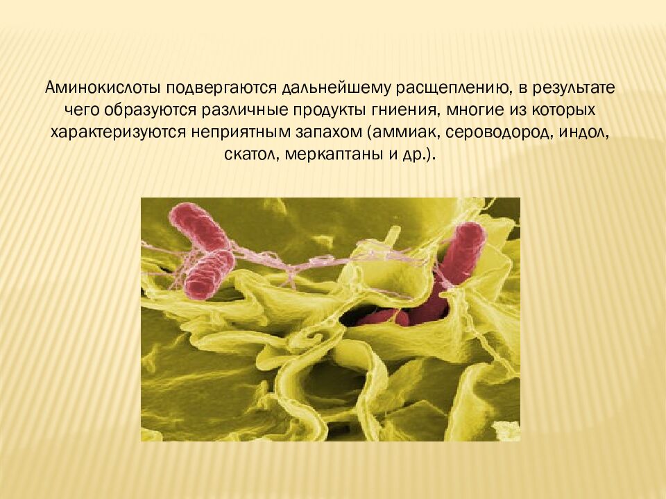 презентация: Тема: «ВИДЫ БАКТЕРИЙ»