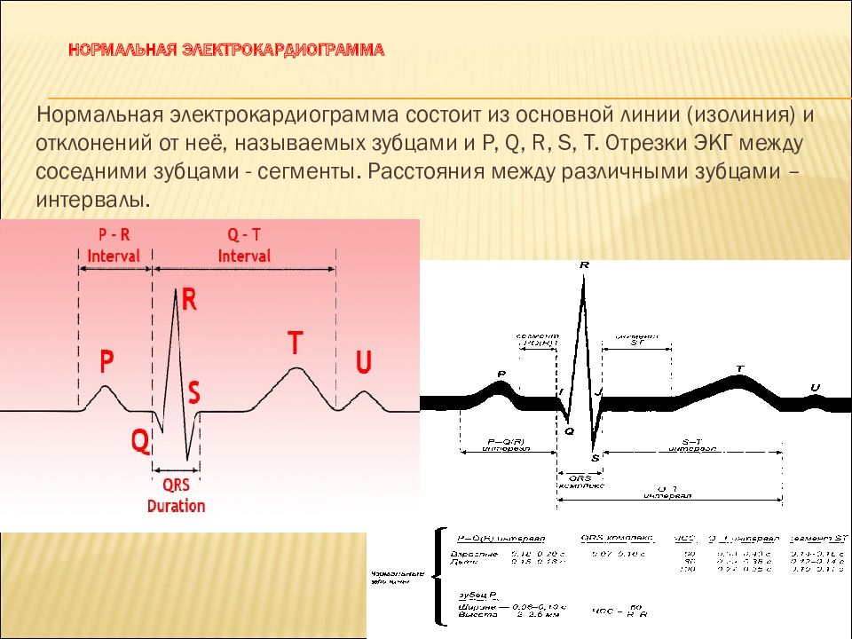 Основы экг презентация