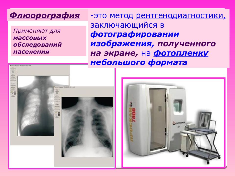 Флюорография картинки для презентации