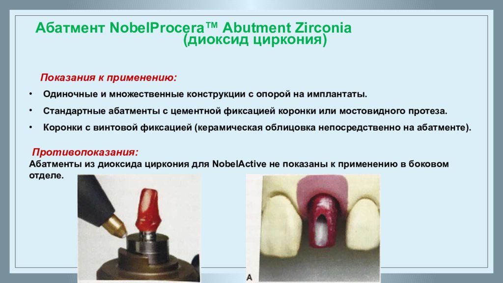 Эндосистемы в стоматологии презентация