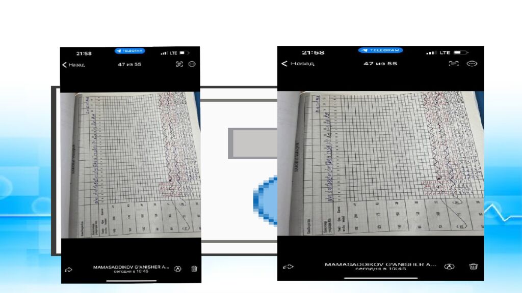 CENTRAL ASIAN MEDICAL UNVERSITETI DAVOLASH ISHI FAKULTETI 421-GURUH TALABASI