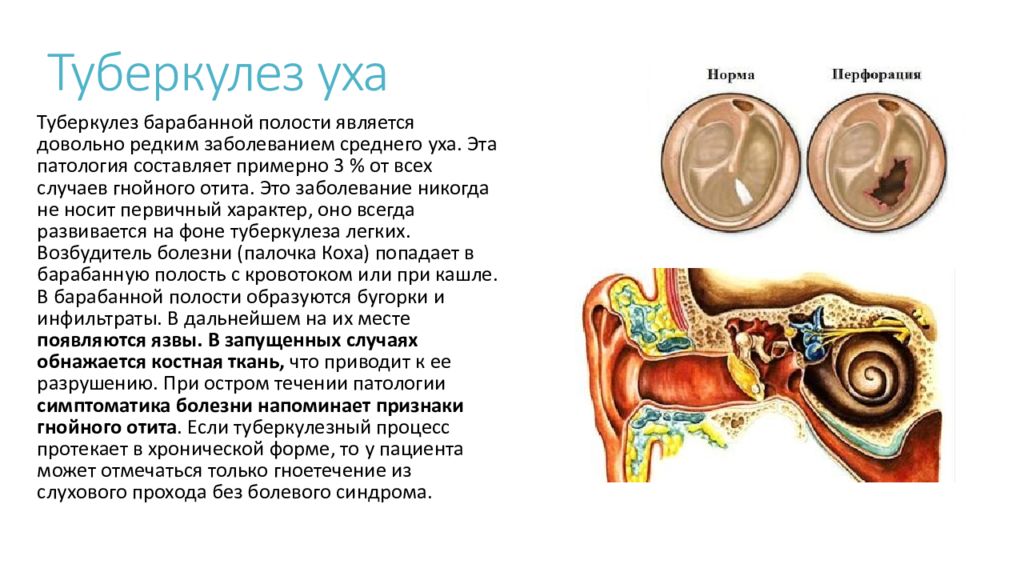 Презентация лор ухо