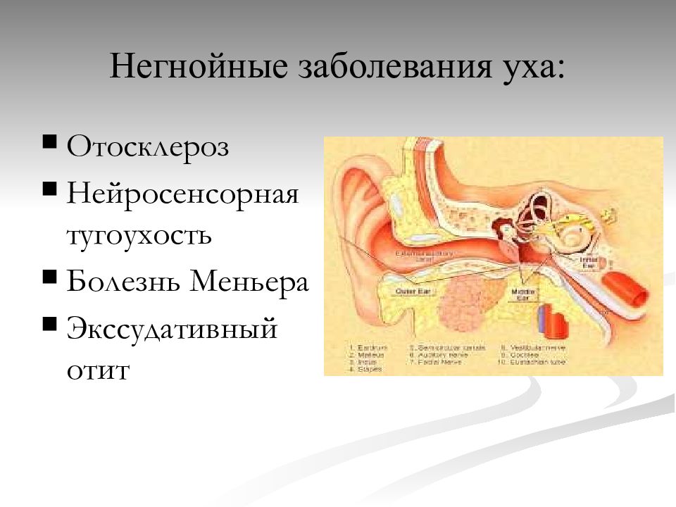 Нарушение среднего уха. Заболевания среднего уха перечислить. Заболевания среднего и внутреннего уха. Негнойные заболевания среднего уха.
