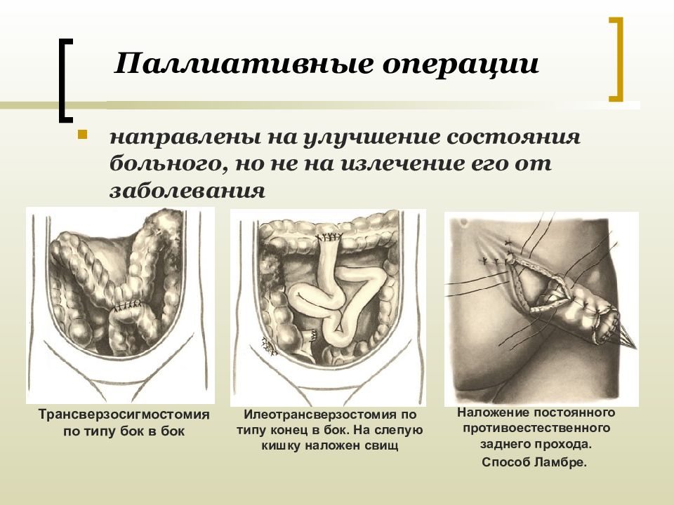 Хирургическая операция презентация