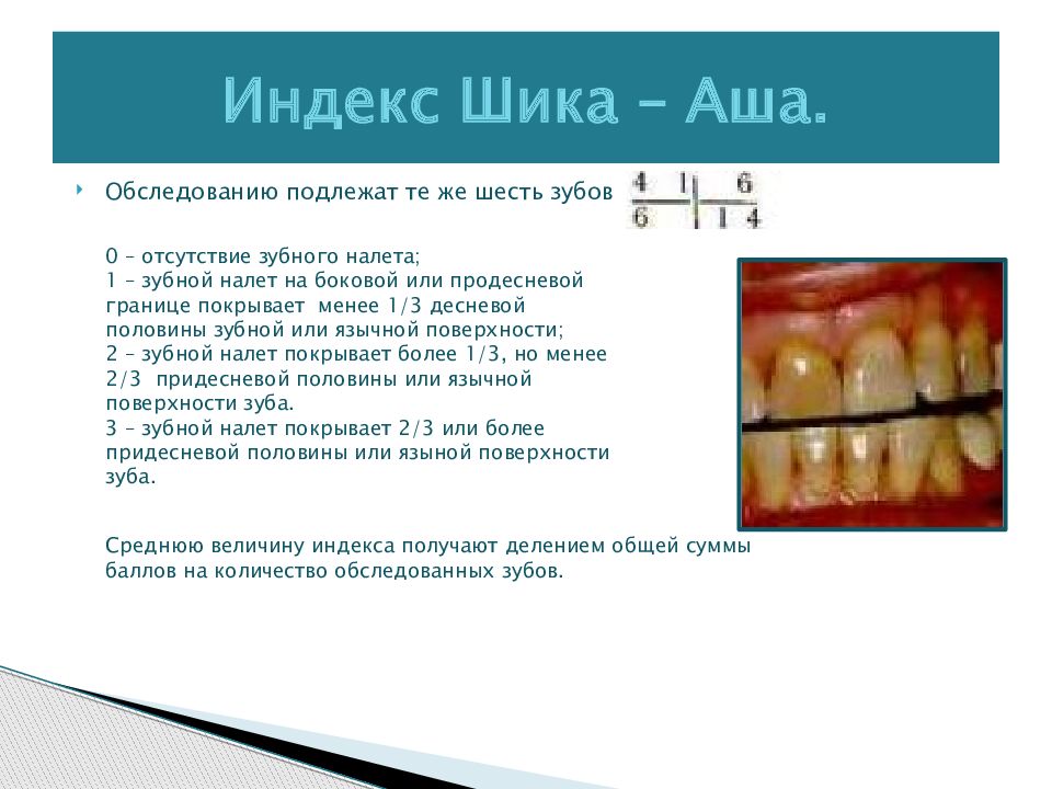 Индексы в стоматологии. Гигиенические индексы для определения зубного налета. Индексная оценка гигиены полости рта. Зубной налет индекс гигиены. Стоматологические индексы гигиены полости рта.