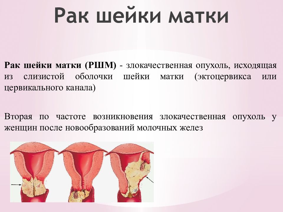 Выделения после удаления матки. РК шейки матки симптомы.