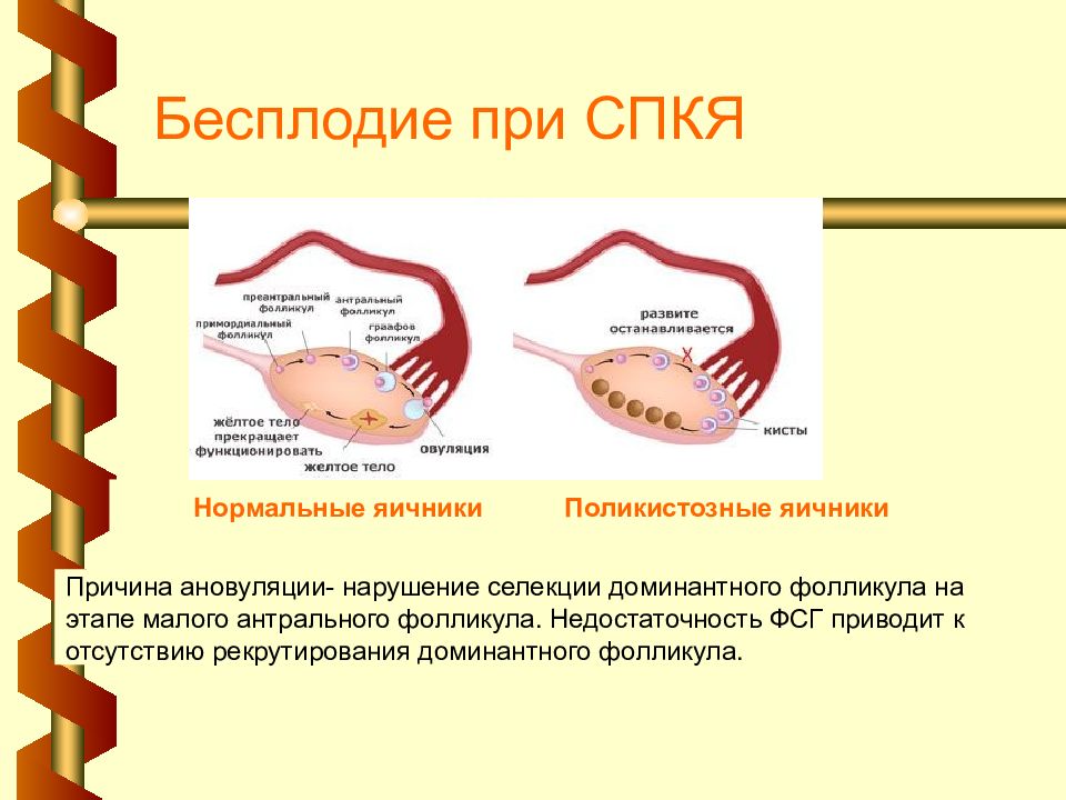 Патогенез спкя презентация