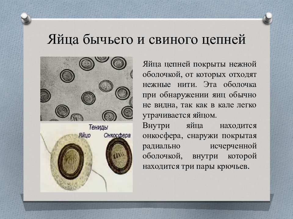 Яйца цепней. Яйца бычьего цепня микроскоп. Строение яйца свиного цепня. Свиной цепень яйцо строение. Яйцо бычьего цепня препарат.