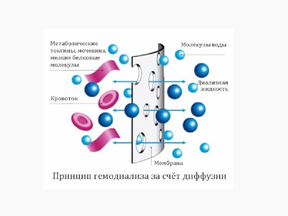 Заместительная почечная терапия презентация