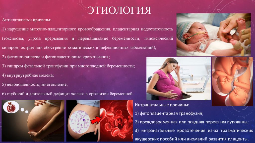 Железодефицитная анемия у детей презентация