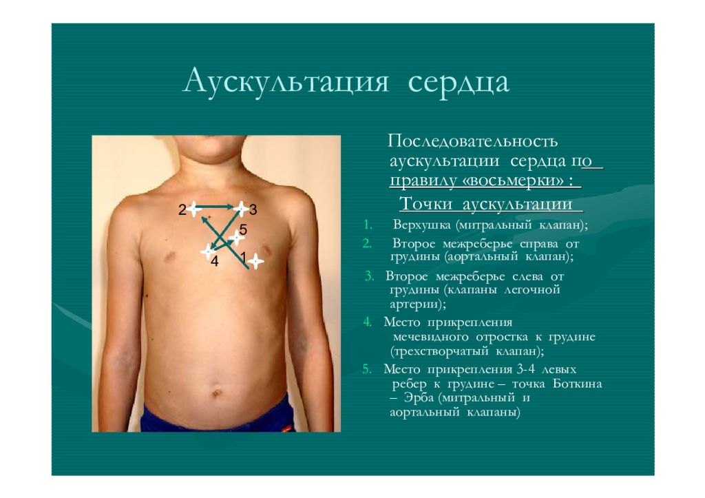 Сосудистый рисунок у ребенка. Точки выслушивания сердца у детей педиатрия. Аускультация точки Боткина Эрба. Точки выслушивания клапанов сердца у детей. Точки аускультации сердца у детей.