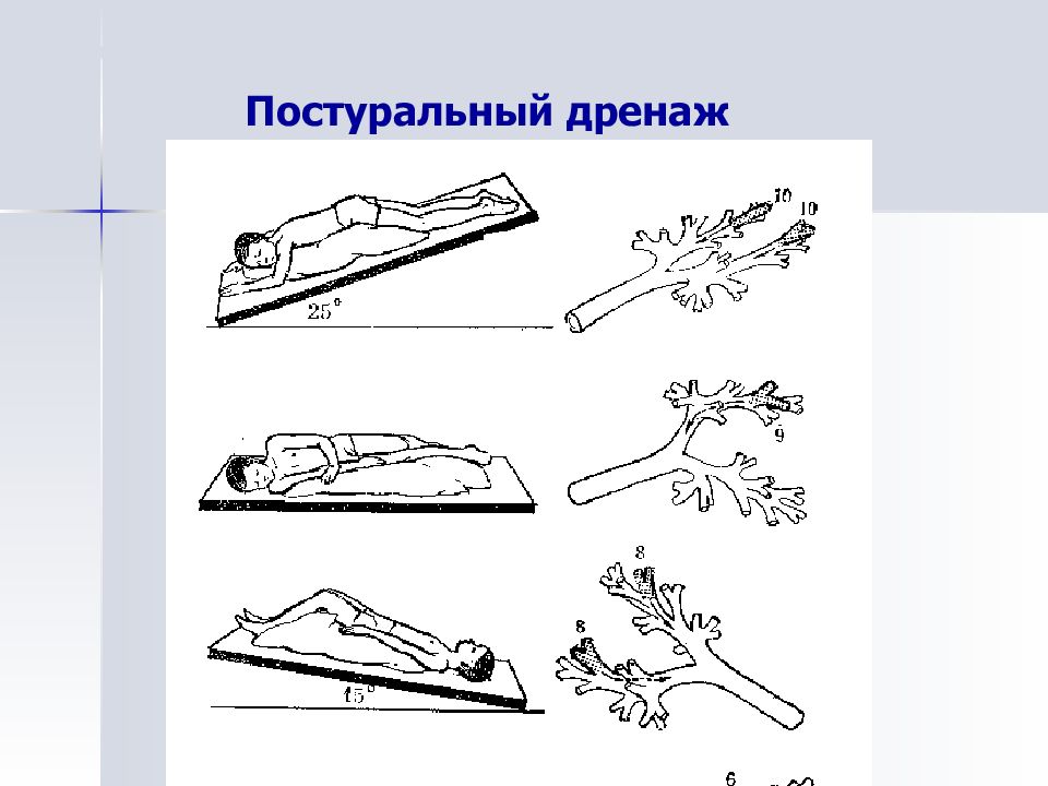 Постуральный дренаж. Позиционный (Постуральный) дренаж. Дренажные положения для отхождения мокроты. Постуральный дренаж бронхов техника. Постуральный дренаж при пневмонии.