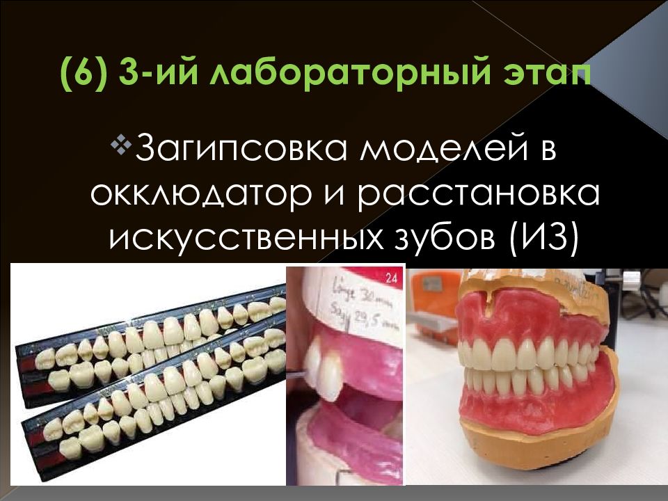 Показания к пластиночным протезам. Загипсовка моделей в окклюдатор и расстановка искусственных зубов. Полный съемный протез презентация. Съемный протез окклюдатор. Загипсовка в окклюдатор бюгельный протез.