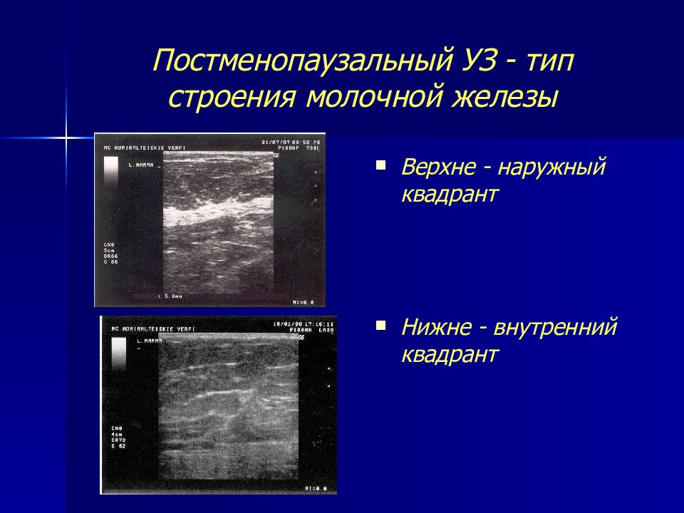 Квадранты молочной железы схема