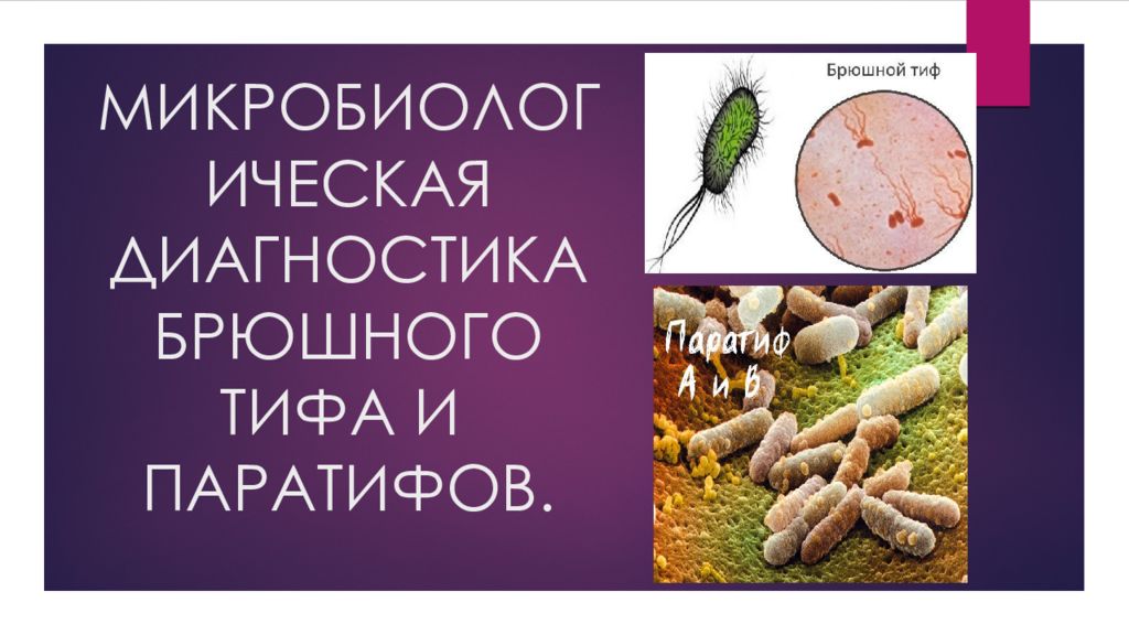 Брюшной тиф кишечные. Брюшной тиф диагностика. Выявление брюшного тифа. Диагностика тифа и паратифа. Тиф и паратиф.