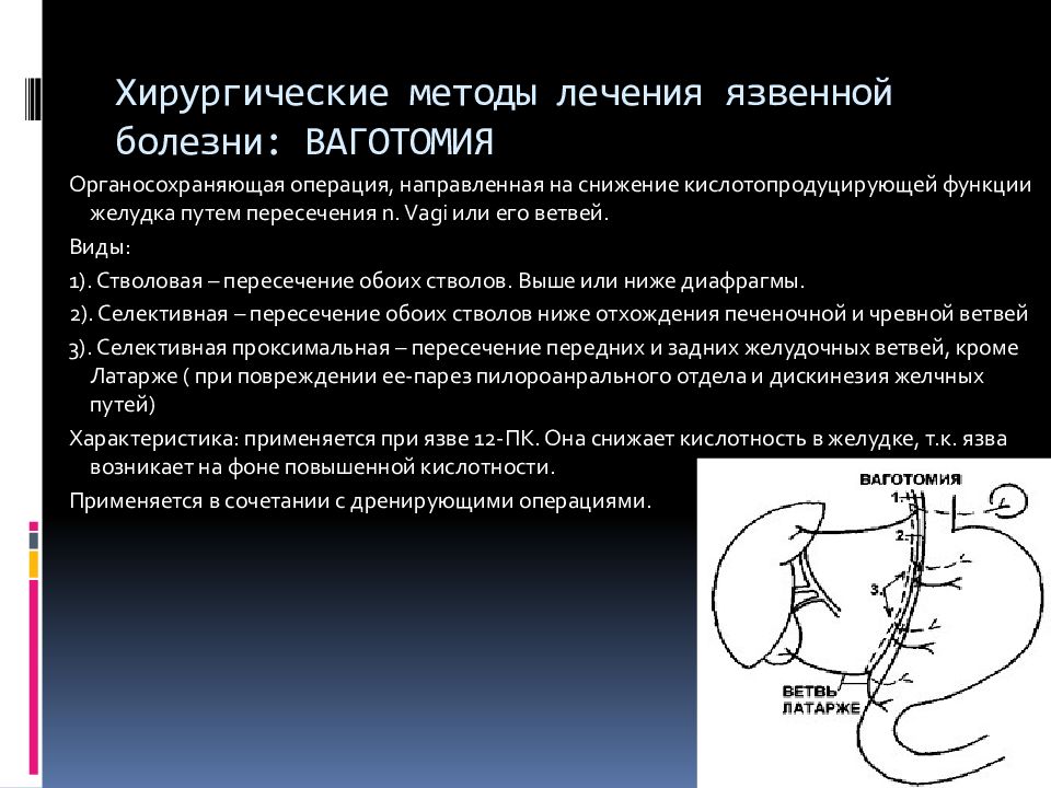 Язвенная болезнь желудка лечение презентация