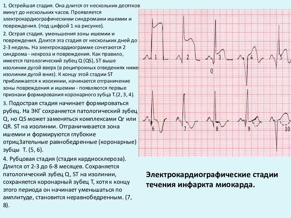 Инфаркт миокарда карта смп