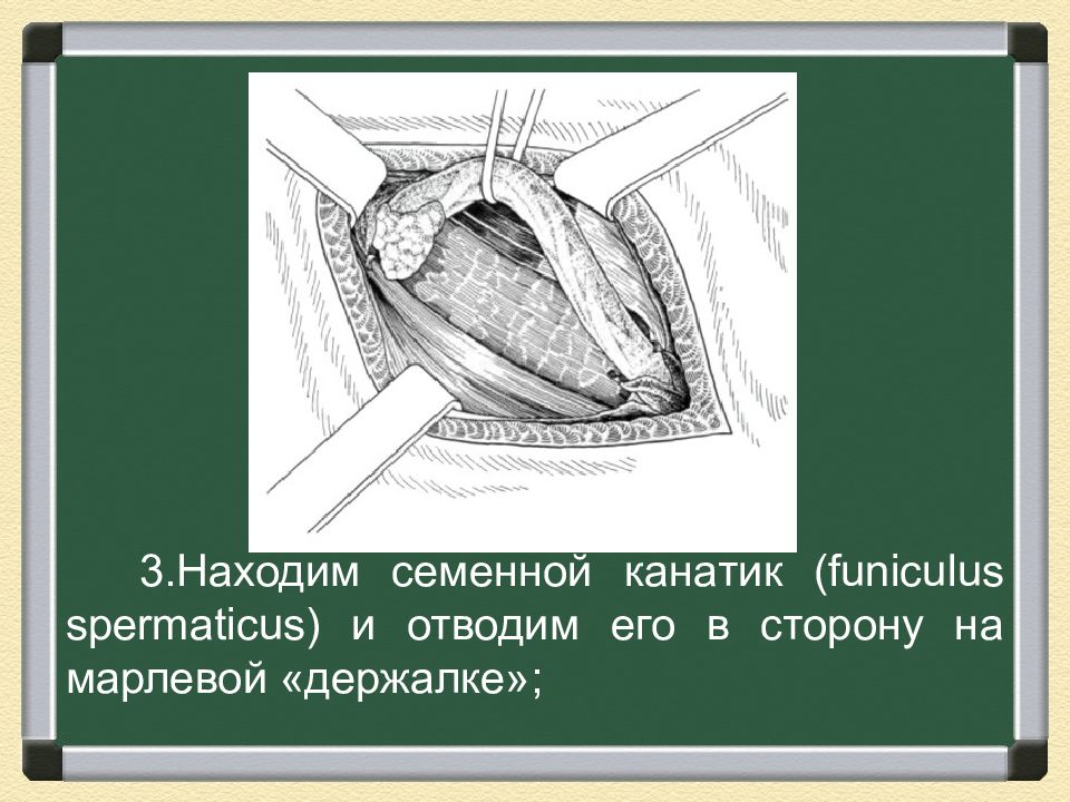 Врожденные грыжи лечение