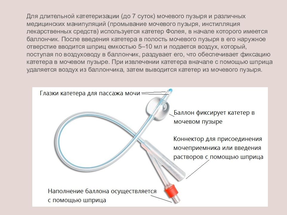 Сестринский уход при заболеваниях мочевыделительной системы презентация