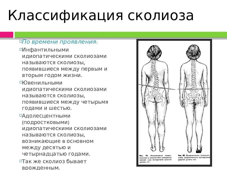 Тестовая карта для выявления нарушений осанки